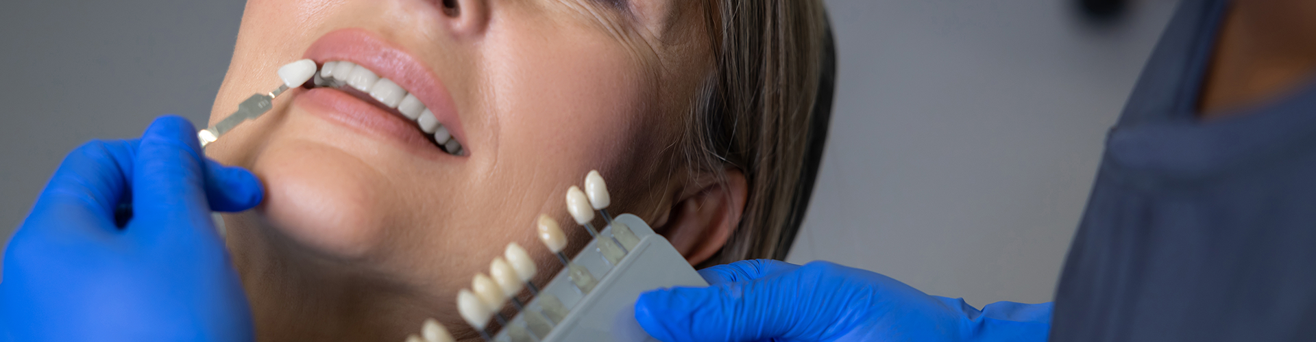 gloved hands-holding tooth shade-matching tool against woman's smile